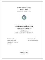 Chẩn đoán hình ảnh u màng não thất