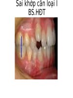 Điều trị sai khớp cắn hạng I