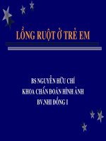 LỒNG RUỘT Ở TRẺ EM, BỆNH VIỆN NHI ĐÔNG 1