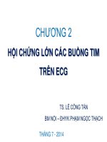Hội chứng lớn các buồng tim trên ECG