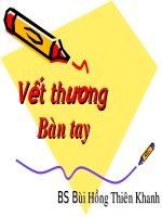 Vết thương bàn tay