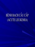 Bệnh bạch cầu cấp