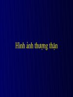 CT hình ảnh chấn thương thận