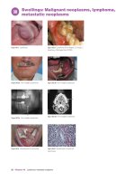 Ebook Oral medicine and pathology at a glance Part 2