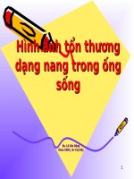 Hình ảnh tổn thương dạng nang trong ống sống