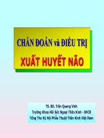 CHUẨN ĐOÁN XUẤT HUYẾT NÃO