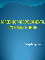 Sang loc trat khop hang