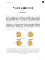 Tài liệu PDF Vision Correction