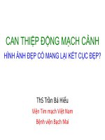Can thiệp động mạch cảnh hình ảnh đẹp sẽ mang tới kết cục đẹp 