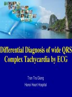 Chẩn đoán tim nhanh với QRS giãn rộng giá trị của các hình ảnh chẩn đoán 