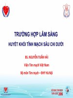 Ca lâm sàng về xử trí huyết khối tĩnh mạch sâu cấp 