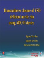 Đóng thông liên thất loại không có gờ động mạch chủ bằng dụng cụ ADO II 