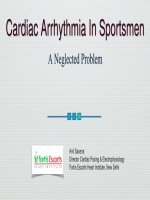 Rối loạn nhịp ở người chơi thể thao vấn đề bị lãng quên 