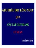 Bài giảng cắt lớp vi tính lồng ngực  giải phẫu