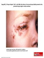 Hesper1 tài liệu y khoa