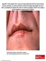 Herpes1 tài liệu y khoa