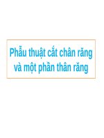 Phẫu thuật cắt chân răng và một phần chân răng