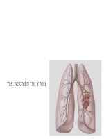 UNG THƯ PHỔI NGUYÊN PHÁT y NHI 