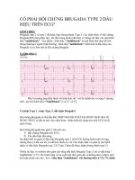 CÓ PHẢI HỘI CHỨNG BRUGADA TYPE 2 (1)