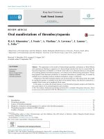 Xuất huyết giảm tiều cầu