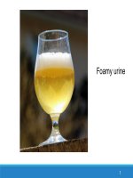 1  nephrotic syndrome  (hội chứng thận hư ở trẻ em)