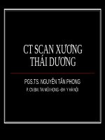 CLVT xuong thai duong thuong 