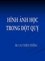 Hình ảnh học trong đột quỵ não 