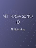 vet thuong so nao ho1 (1)