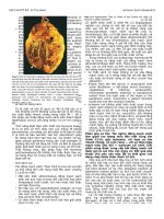 Nhoi mau co tim   robbin