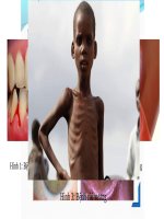 VITAMIN và MUỐI KHOÁNG sinh học 8 giáo án powerpoint  bài giảng điện tử