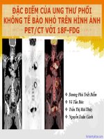Đề tài nghiên cứu: Đặc điểm của ung thư phổi không tế bào nhỏ trên hình ảnh PETCT với 18F-FDG