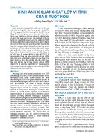 Hình ảnh X quang cắt lớp vi tính của u ruột non