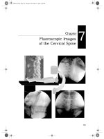 Ebook The handbook of C-ARM fluoroscopy guided spinal injections: Part 2