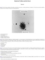 Ebook Surgery pretest self assessment and review (13th edition): Part 2