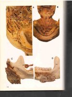 Ebook Clinical atlas of head and neck anatomy: Part 2