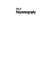 Ebook Atlas of polysomnography (2/E): Part 1