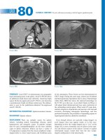 Ebook CT and MRI of the abdomen and pelvis - A teaching file (3rd edition): Part 2