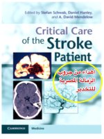Ebook Critical care of the stroke patient: Part 1