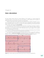 Ebook ECG workbook (3rd edition): Part 2