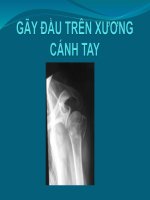 GÃY ĐẦU TRÊN XƯƠNG CÁNH TAY, ĐH Y DƯỢC TP HCM