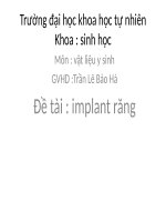 kĩ thuật implant răng