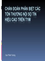 T1W   hyperintensity 