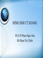 Hình ảnh CT xoang 