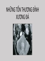 Bài giảng Những tổn thương đỉnh xương đá
