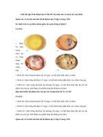 Tải Giải bài tập SGK Khoa học 5 bài 58: Sự sinh sản và nuôi con của chim - Giải bài tập môn Khoa học lớp 5 tập 2