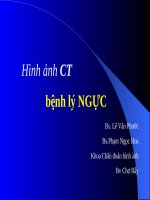 CT NGUC (2).PPT