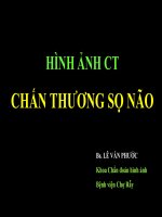 Chanthuongsonao