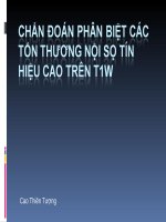 T1W+_+hyperintensity