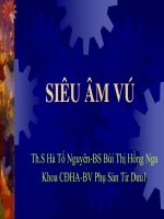 SIEU AM VU