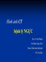 Copy of CT NGUC BS PHUOC 